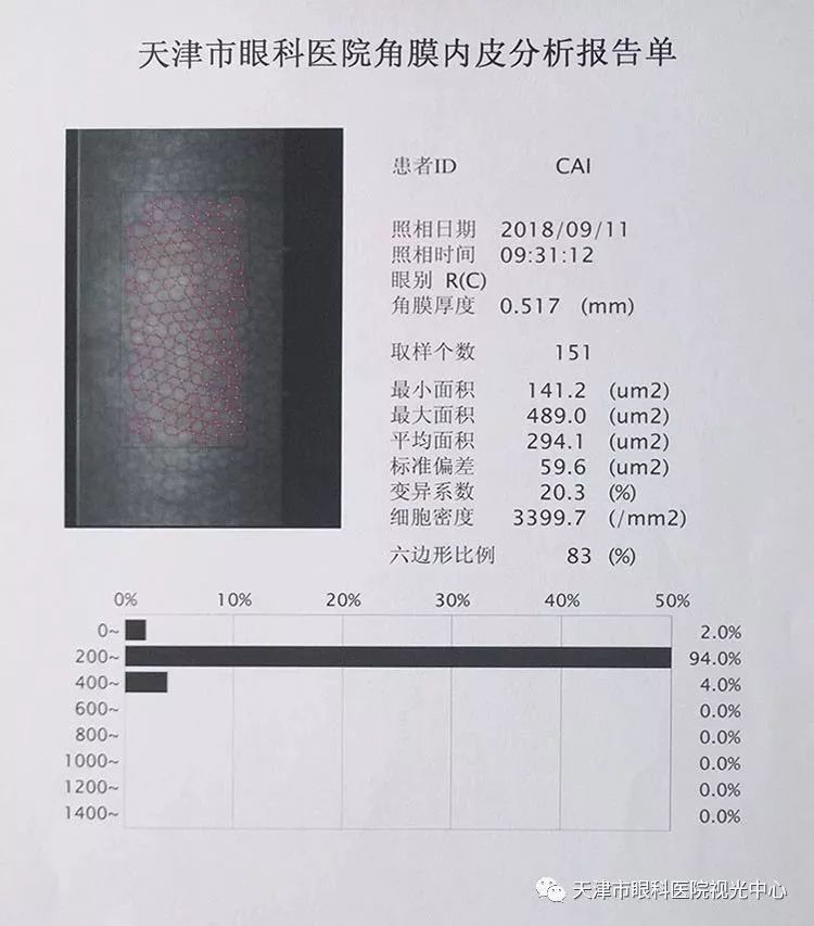 眼睛内皮细胞正常值及其重要性