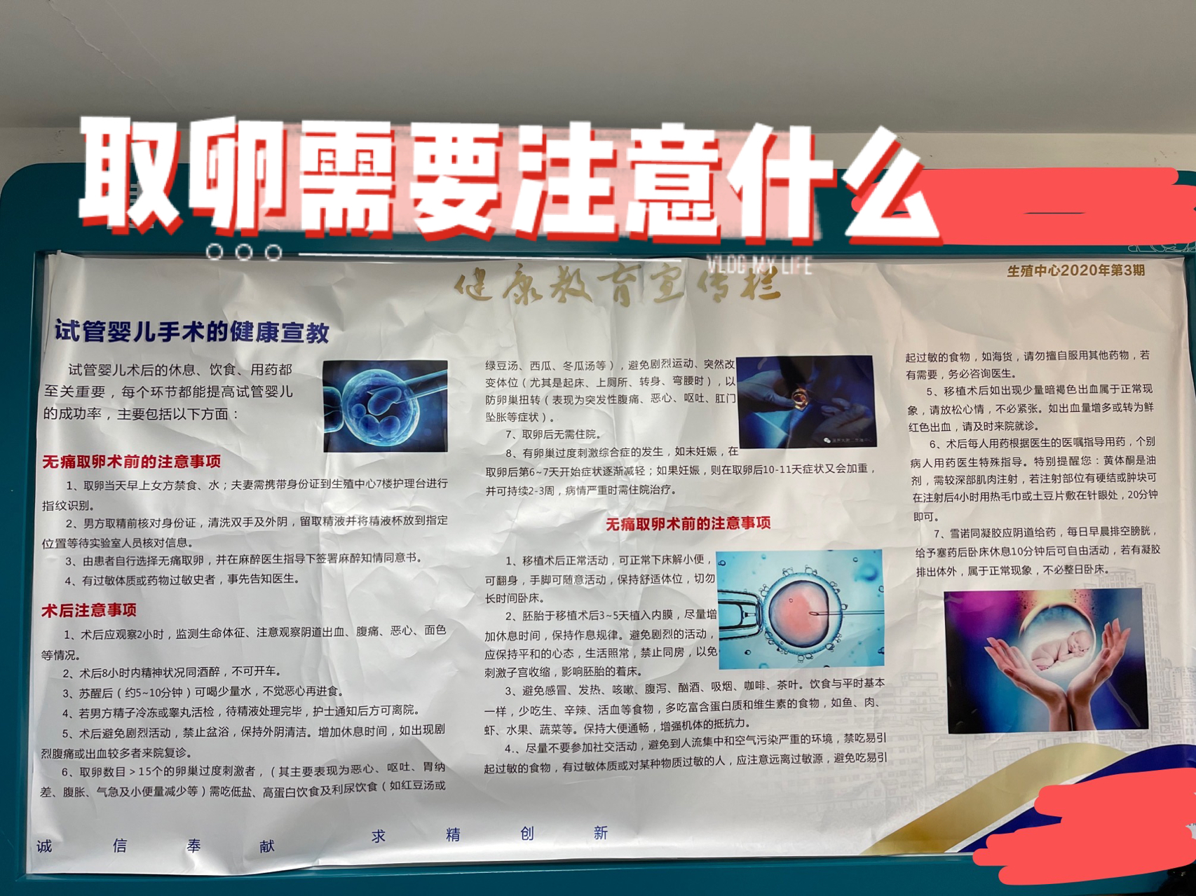 取卵手术注意事项