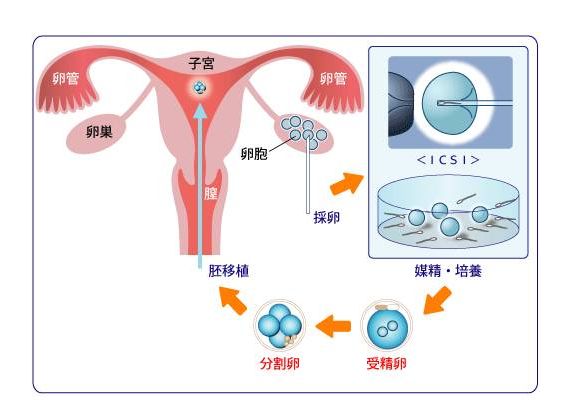 取卵后多少天移植，时间与过程的解析