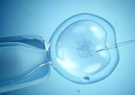 取卵当天注意事项，全面指南与关键要点解析