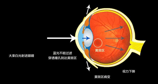 如何辨别防蓝光眼镜真假