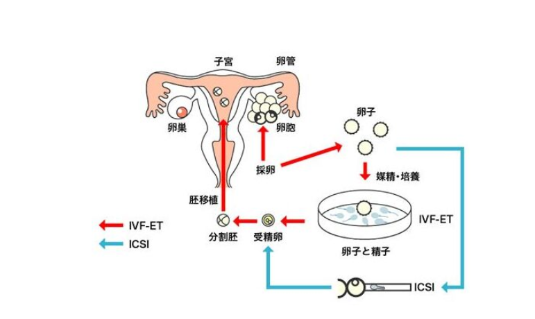 取卵流程详解
