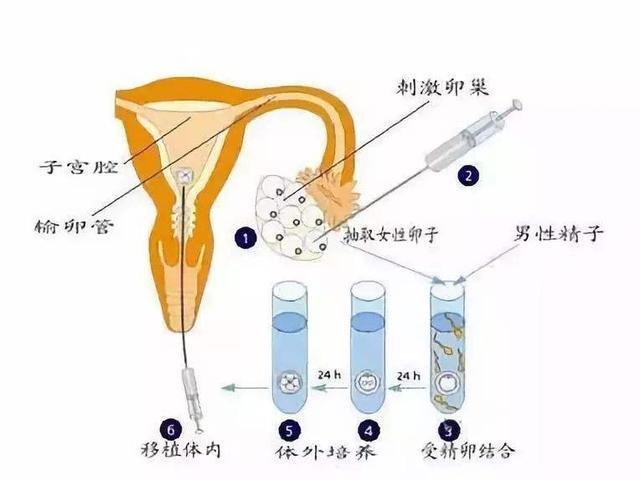 试管取卵，关于时间与例假的深度解析